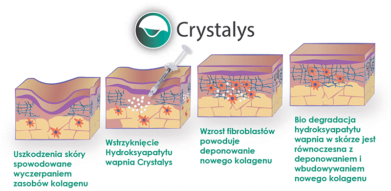 Crystalys™ — Benefits of the Crystalys formula