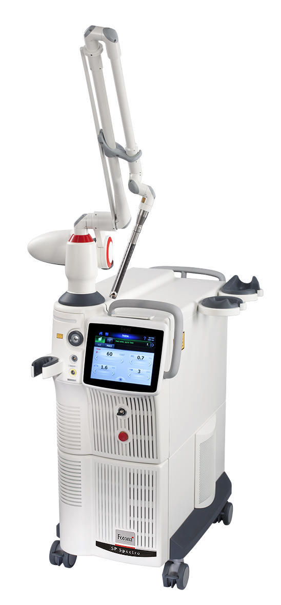 Laser pigmentation removal — Laser pigmentation removal with the Fotona laser