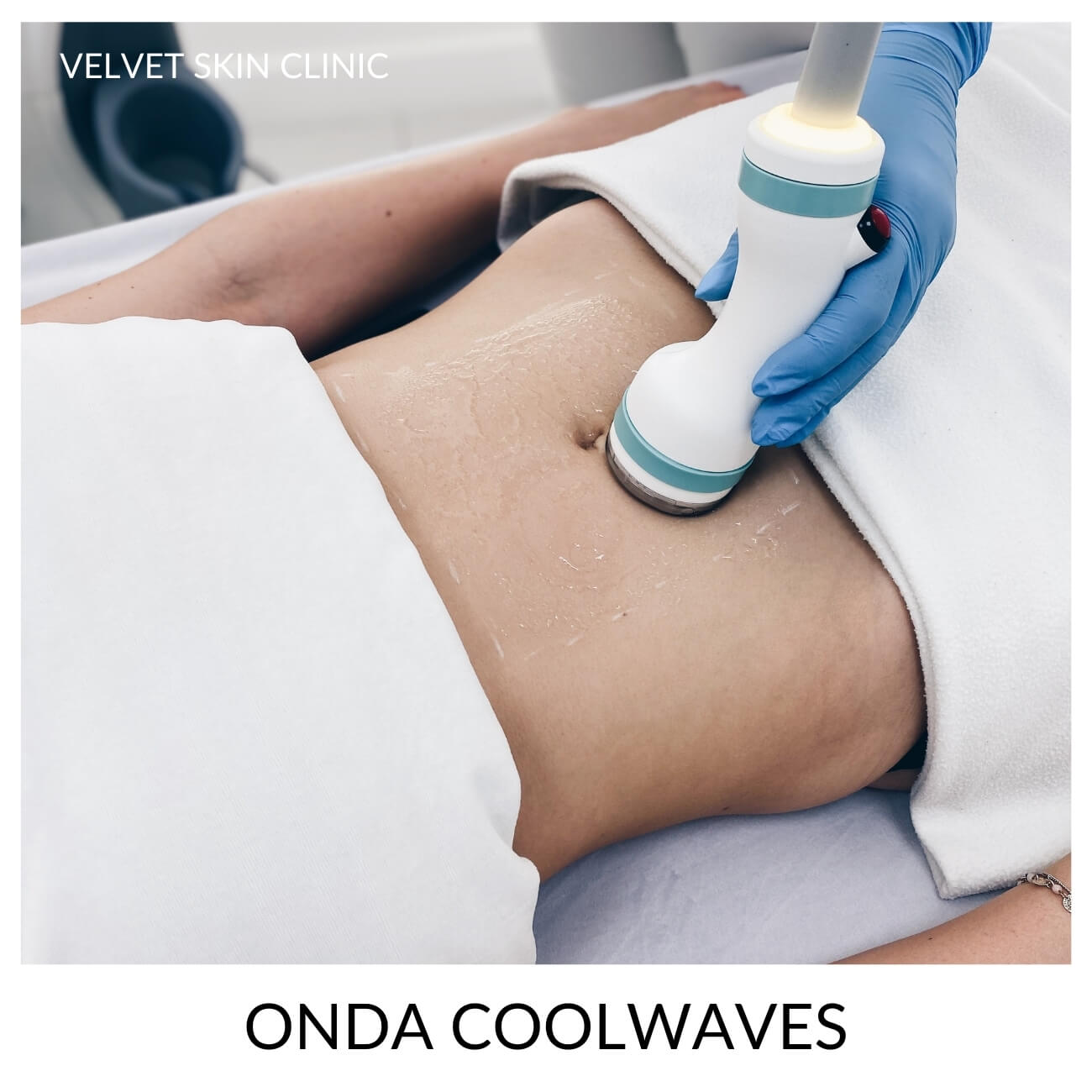 Onda Coolwaves — body-contouring treatment on the abdomen, Velvet Skin Clinic Warszawa