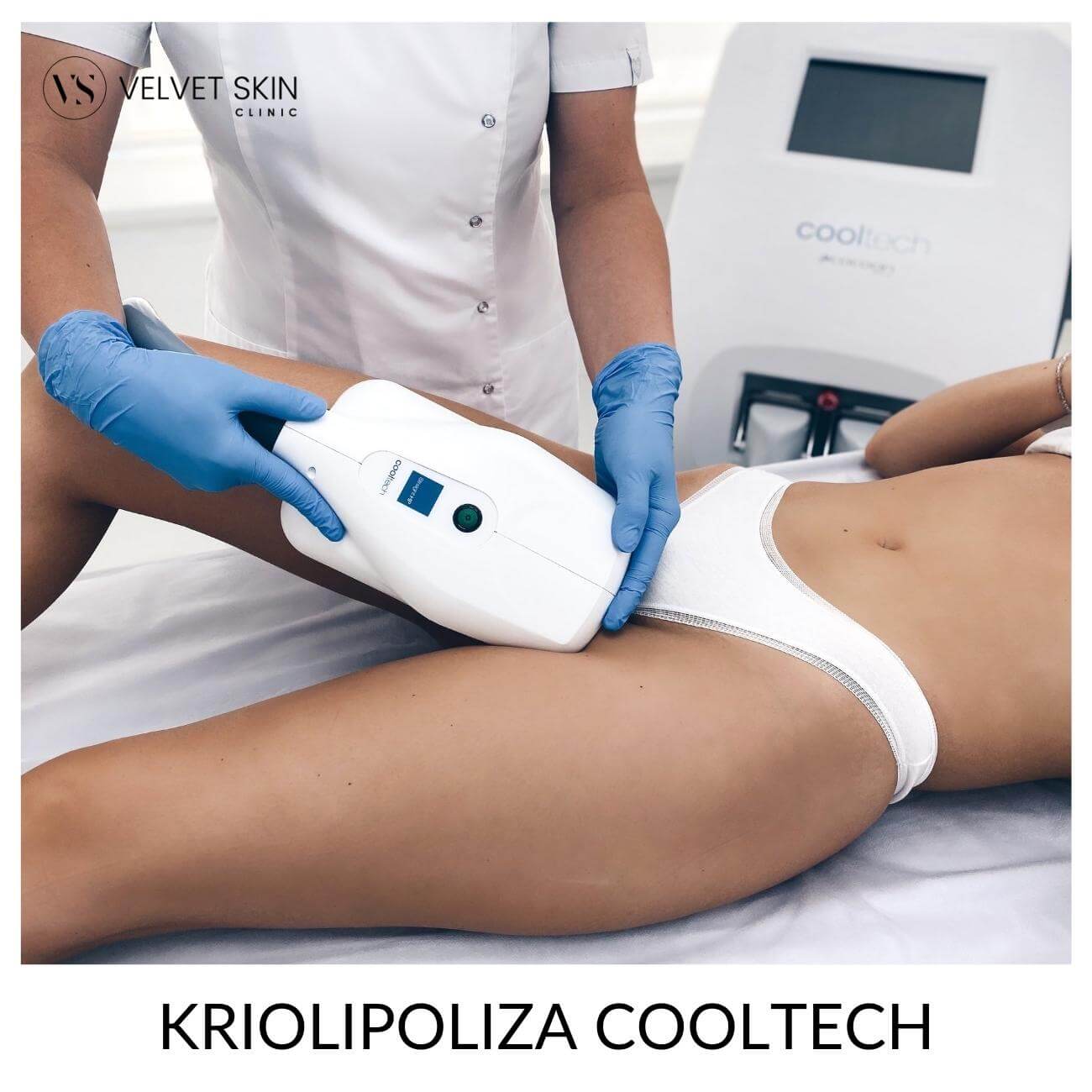 Cooltech cryolipolysis — inner thigh treatment, Velvet Skin Clinic