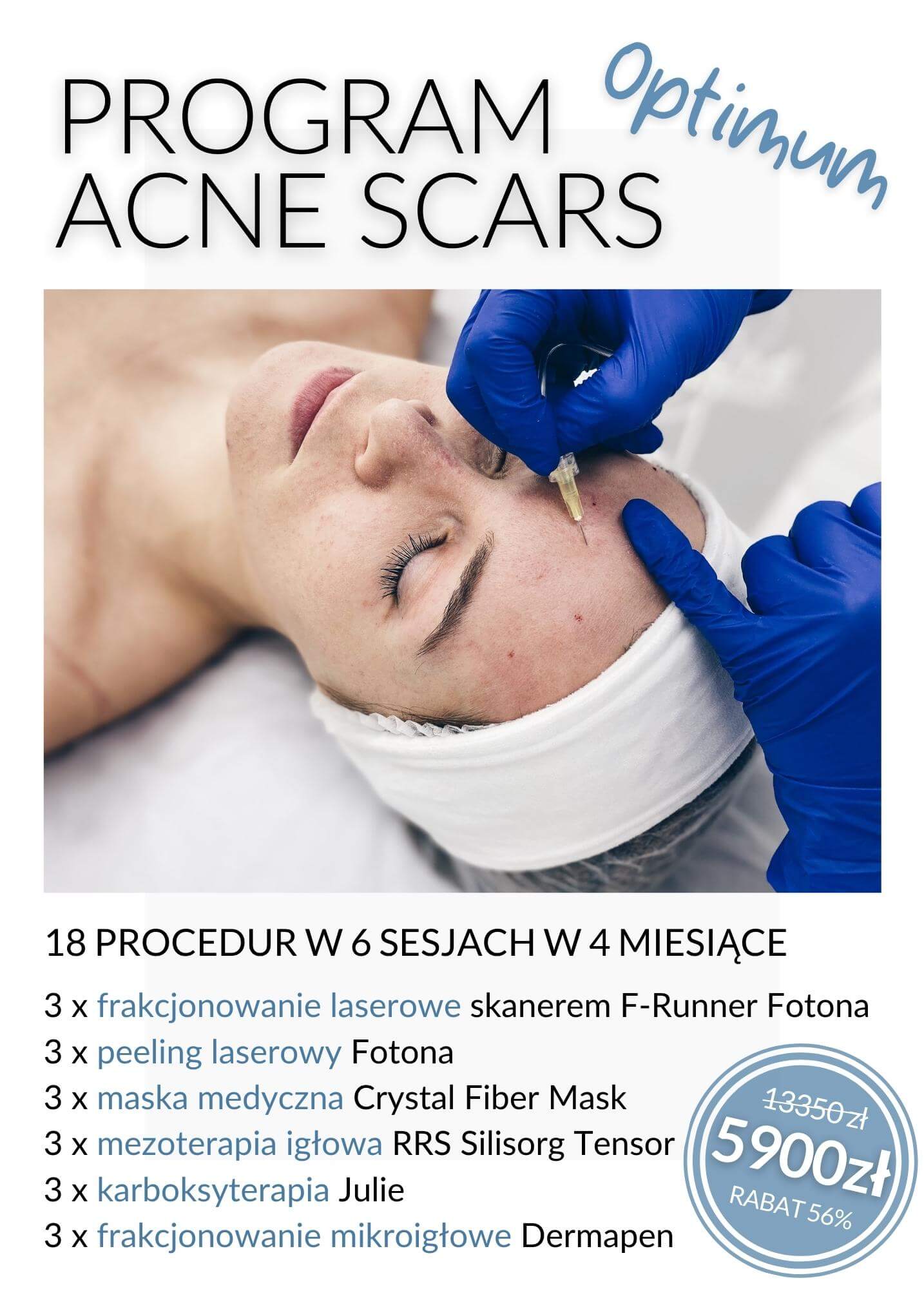 Program Acne Scars Optimum — laserowa redukcja blizn potrądzikowych