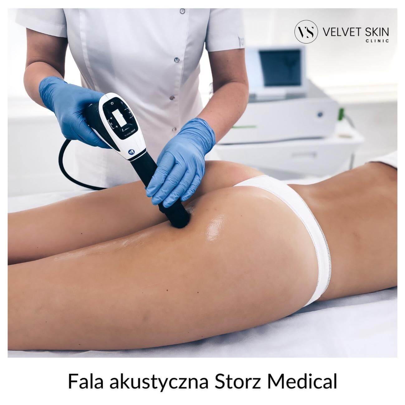 Storz Medical Acoustic Wave Therapy™ — Storz Medical™️ acoustic wave therapy for body contouring