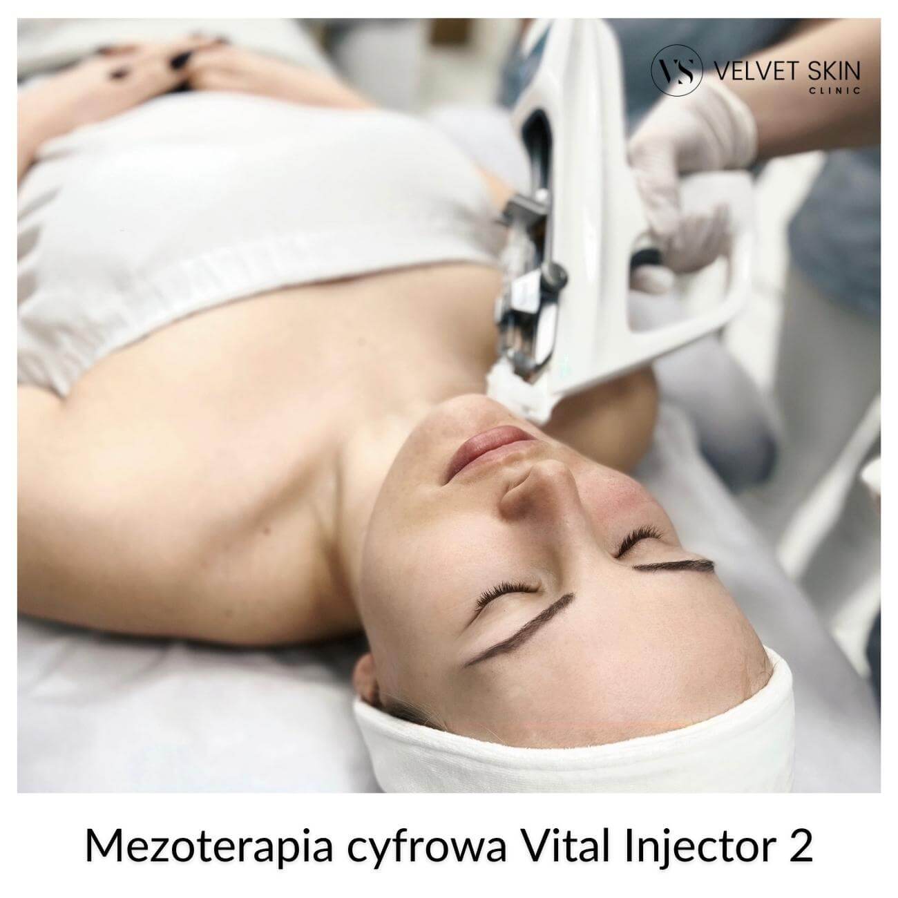 Vital Injector 2 Mesotherapy — The Vital Injector 2 Treatment Procedure