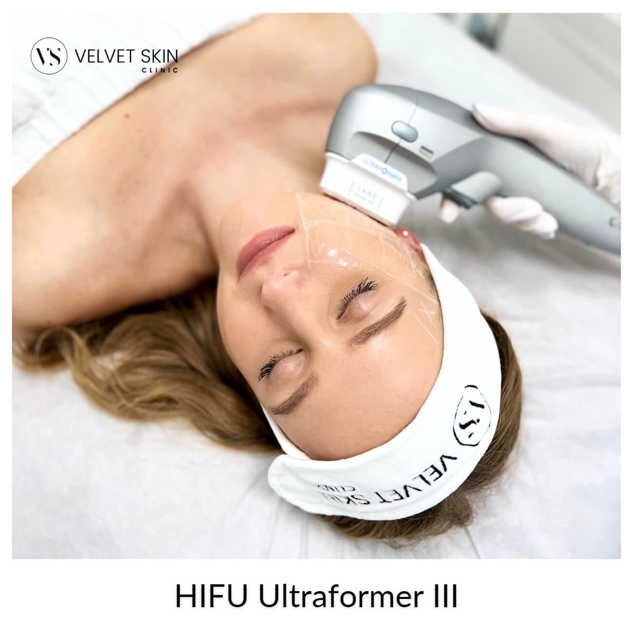 HIFU Ultraformer III — ultrasound handpiece during a facial lifting treatment