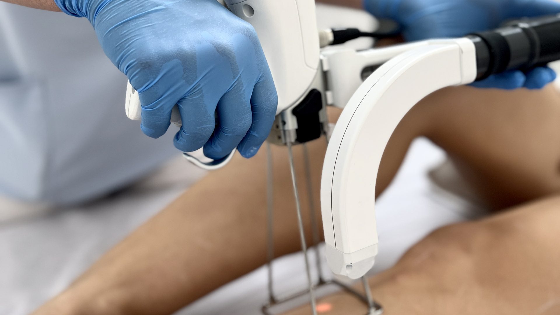 Depilacja laserowa nóg w Velvet Skin Clinic — głowica lasera podczas zabiegu